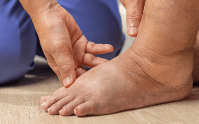 March is Lymphedema Awareness Month