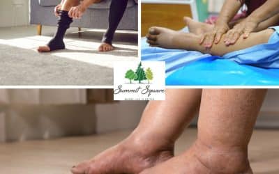 Lymphedema Therapy at Summit Square: A Life-Changing Experience